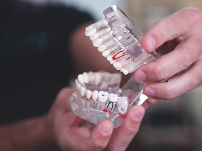 Network out insurance understanding vs tags dental